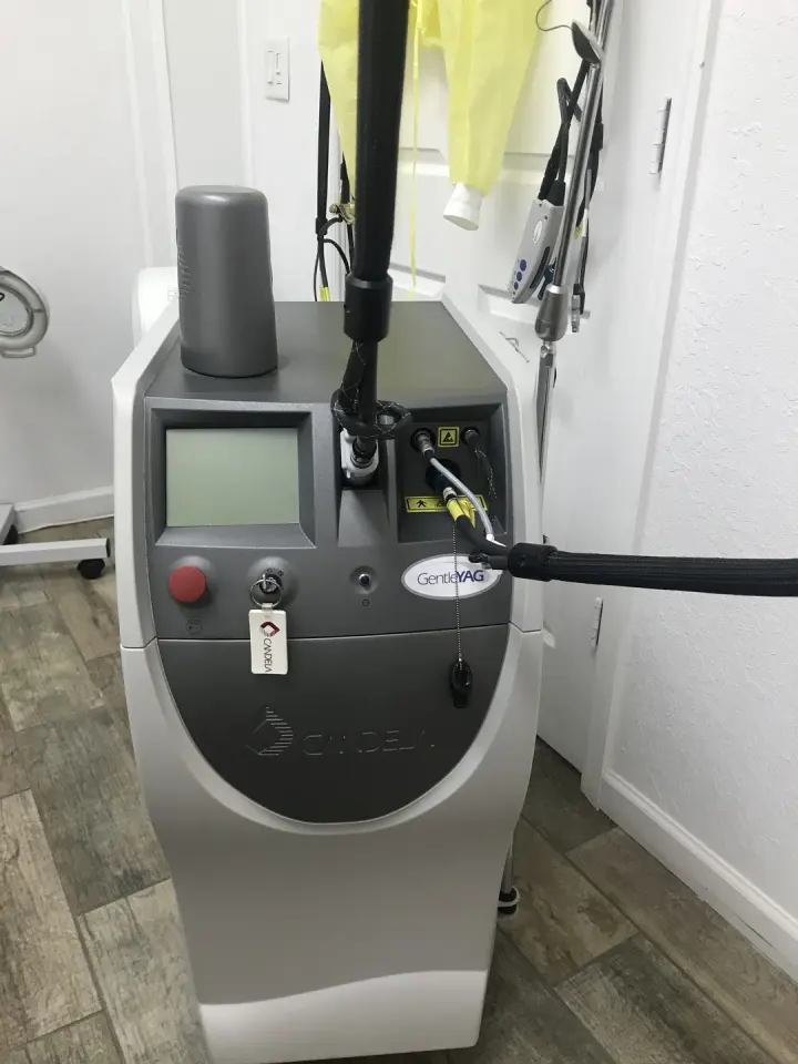 Candela GentleYAG laser machine inside Gentle Zap Laser Med Spa, Miami